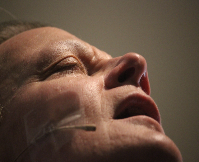 Nahaufnahme eines FrauenGesichts während eines Facelift-Vorgangs mit Nadeln in der Nase und einer Wand im Hintergrund.