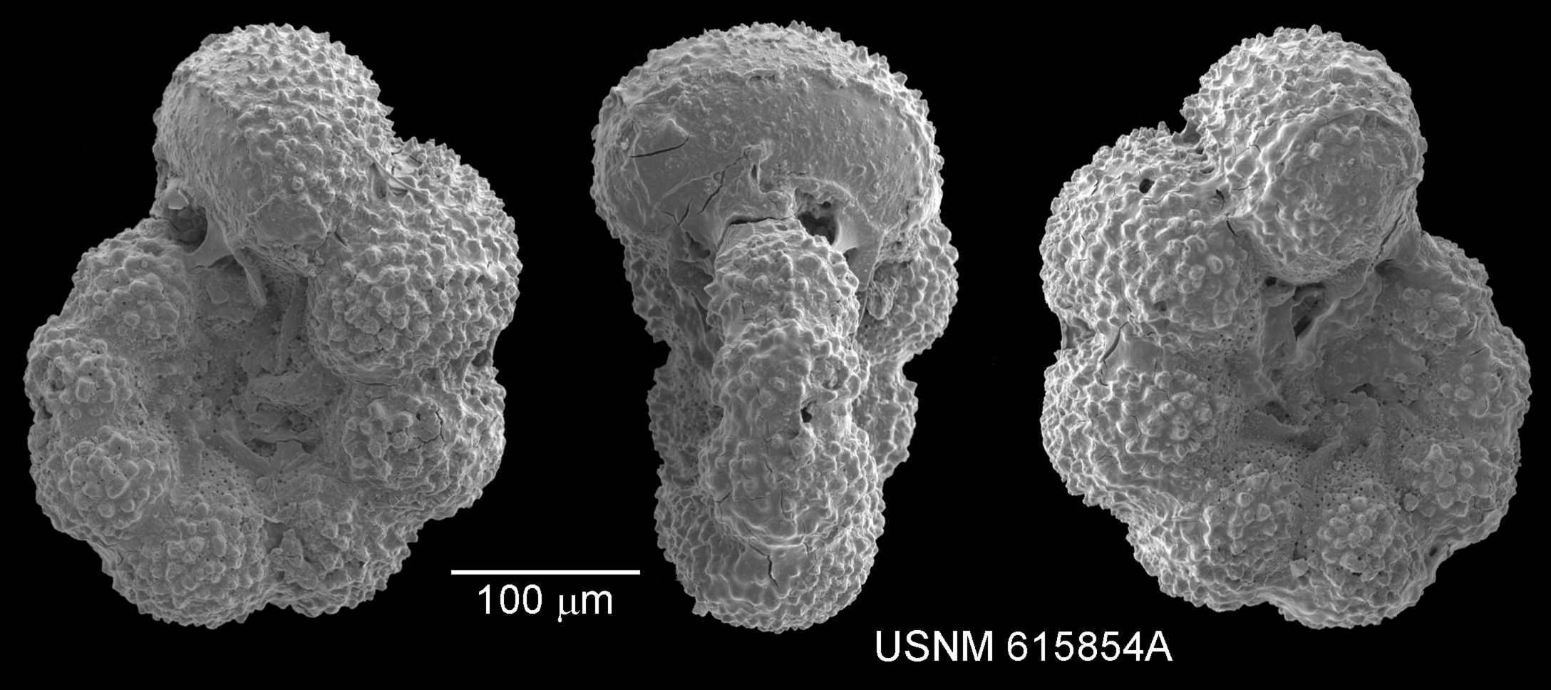Schwarzes und weißes Mikroskopbild von drei verschiedenen Krebszelltypen auf dunklem Hintergrund mit der Beschriftung "USNM 615854A" unten.