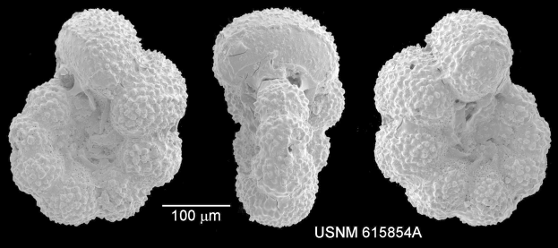 Schwarzes und weißes Mikroskopbild von drei verschiedenen Krebszelltypen auf dunklem Hintergrund mit der Beschriftung "USNM 615854A" unten.